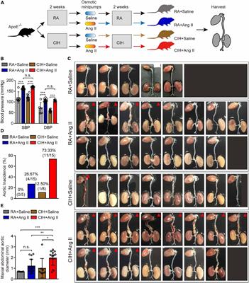mRNA, lncRNA, and circRNA expression profiles in a new aortic dissection murine model induced by hypoxia and Ang II